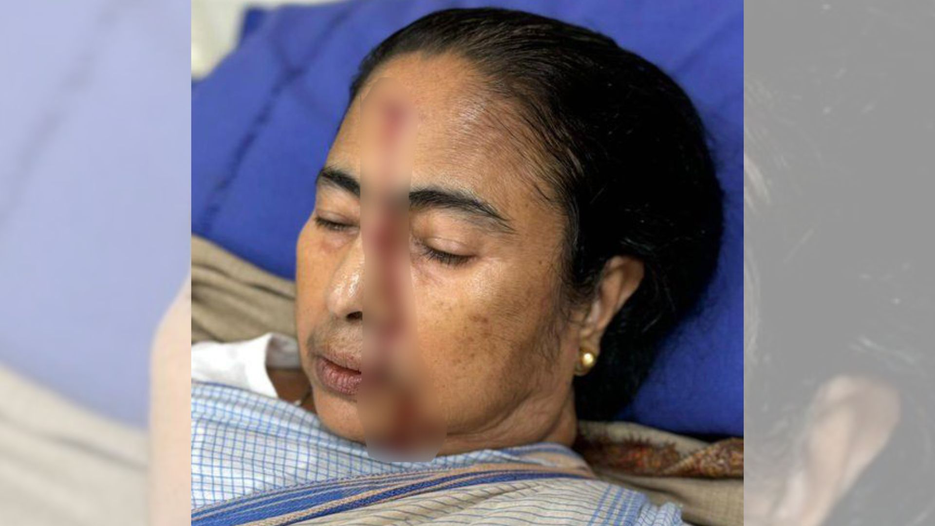 নিজ বাড়িতে পা পিছলে কপালে আঘাত পেলেন মমতা