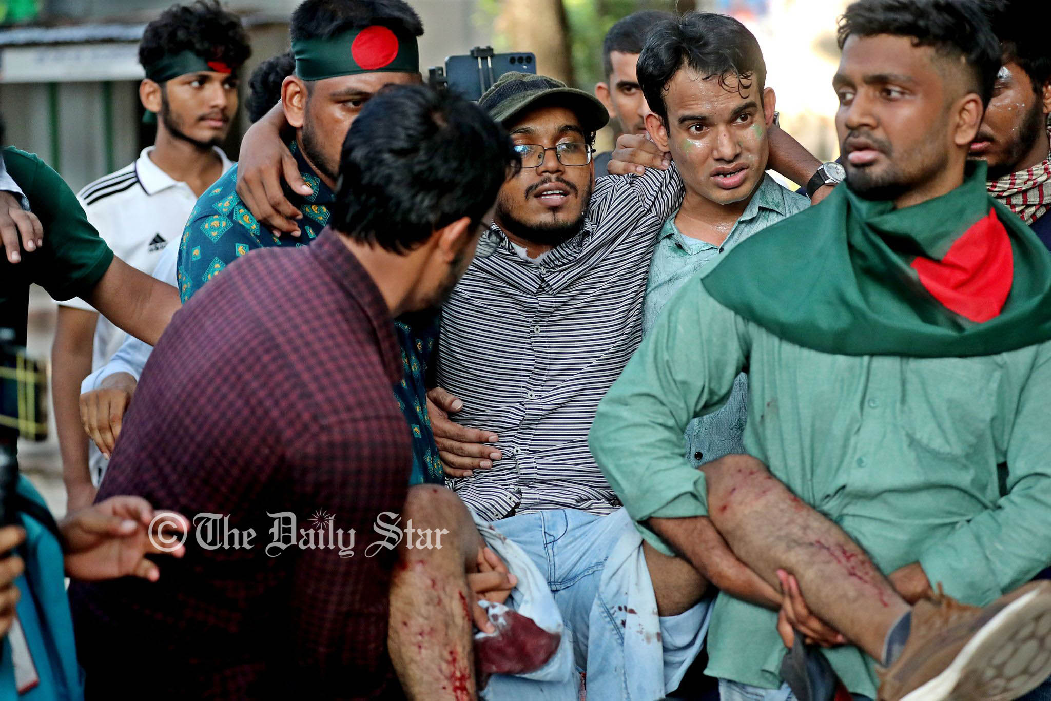 ঢাবিতে ২ শিক্ষার্থী গুলিবিদ্ধ, টিয়ারশেল-সাউন্ড গ্রেনেডে আহত অন্তত ১৫