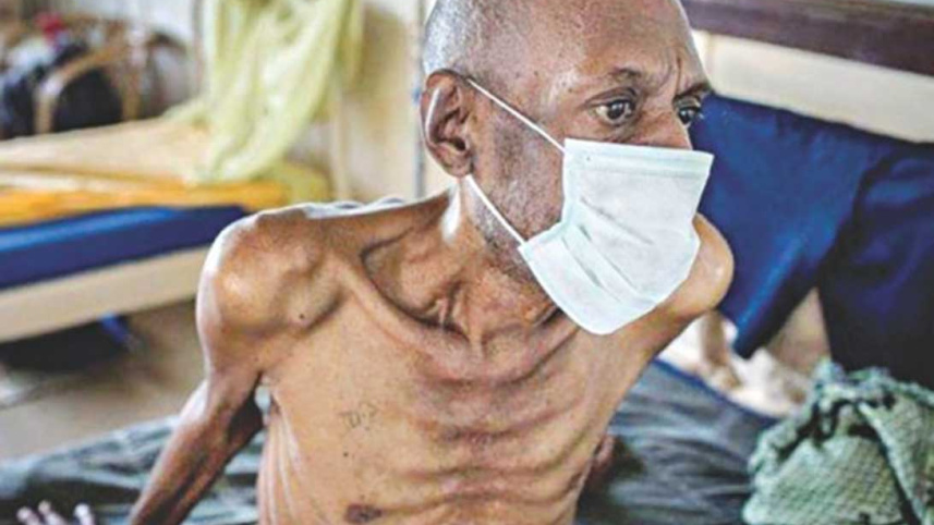 tuberculosis_0.jpg