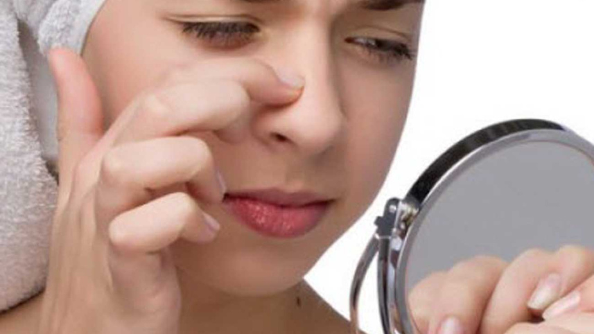 whiteheads-on-nose