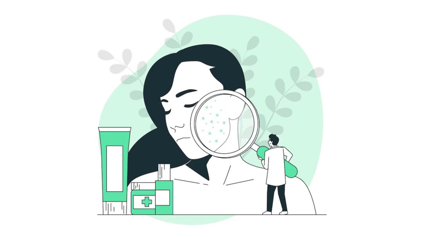 acne-1.jpg