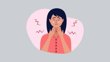 Pharyngitis
