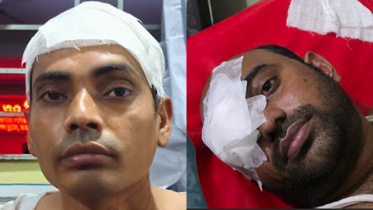 আহত সাংবাদিক তায়েফুর রহমান তুহিন ও সাদ্দাম হোসেন। ছবি: স্টার