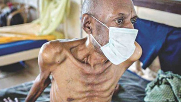 tuberculosis_0.jpg