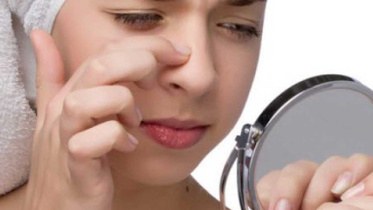 whiteheads-on-nose